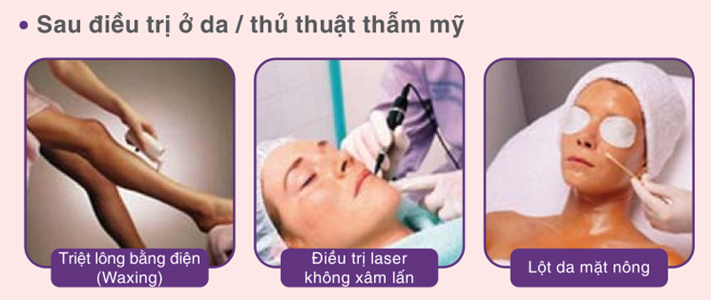 Kem Dưỡng Bioderma Cicabio Crème phục hồi da sau điều trị, thủ thuật thẩm mỹ: laser, lăn kim, peel da hay nặn mụn...